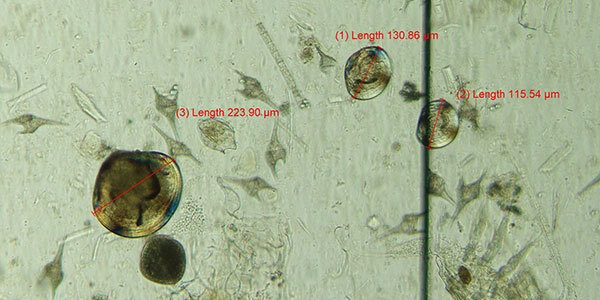 Microscopic view of water sample; three zebra mussel with lengths of 223, 130, and 115 micrometers are visible